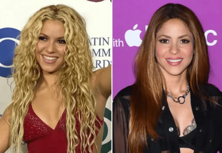 shakira teeth before after