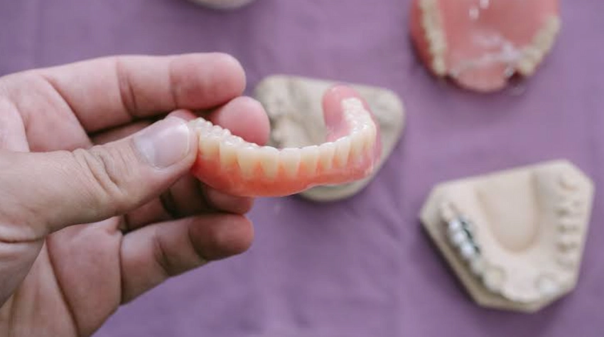 the truth about new dentures and adhesive a clinical guide the truth about new dentures and adhesive a clinical guide