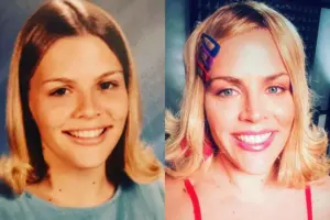 busy philipps teeth before after