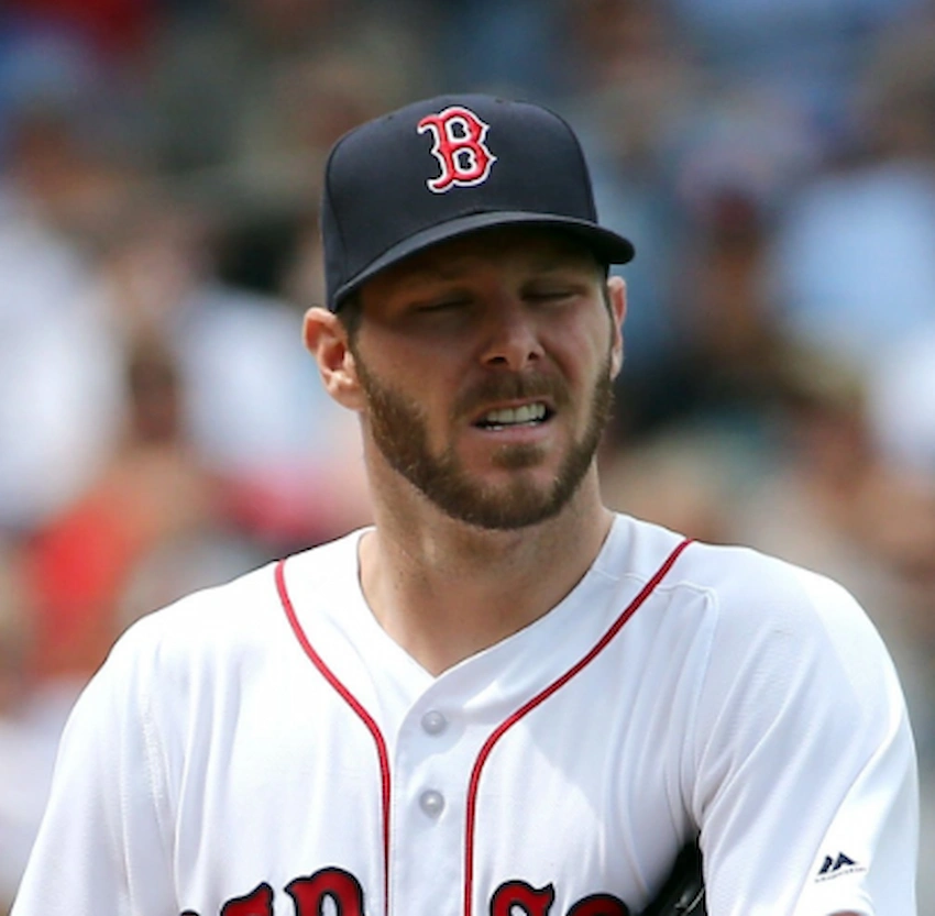 chris sale teeth 2018 chris sale teeth 2018