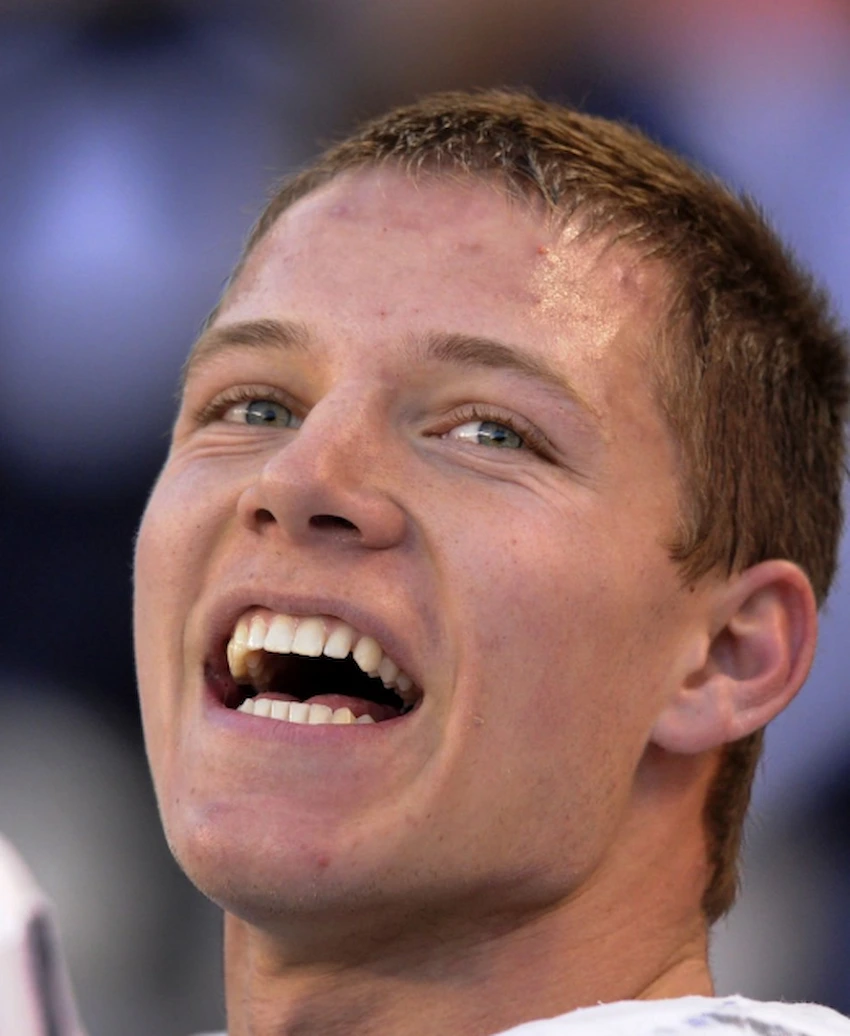 christian mccaffrey teeth 2013