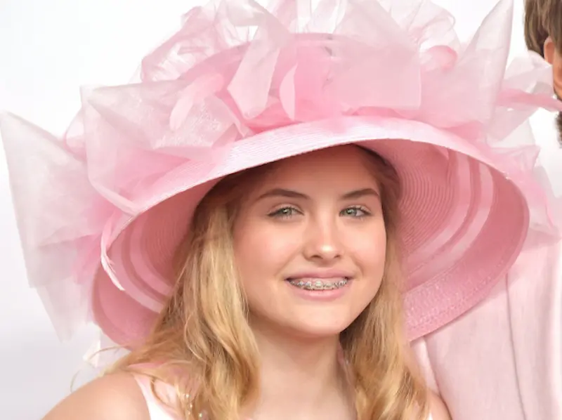dannielynn birkhead teeth in 2020
