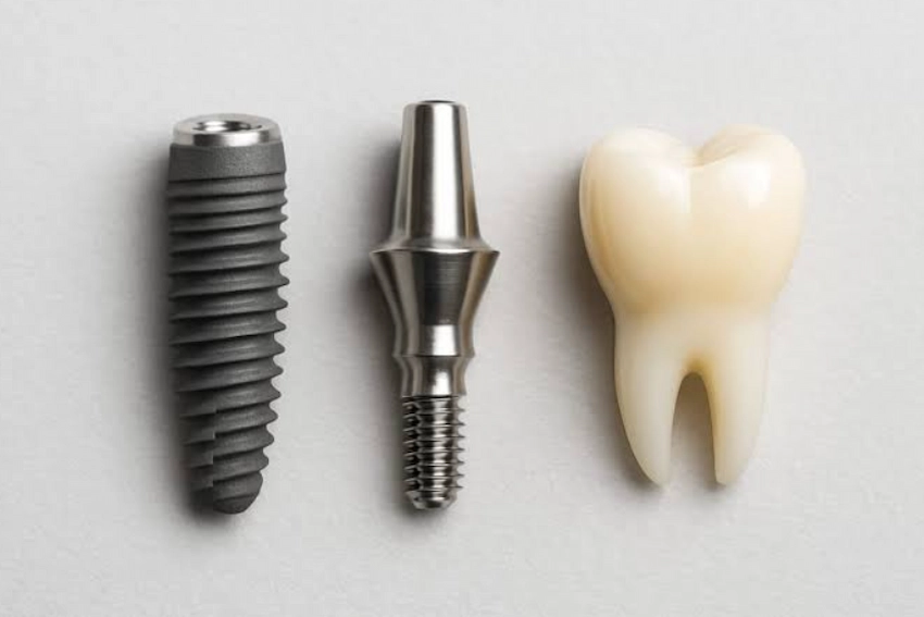 dental implant guide at lema dental clinic