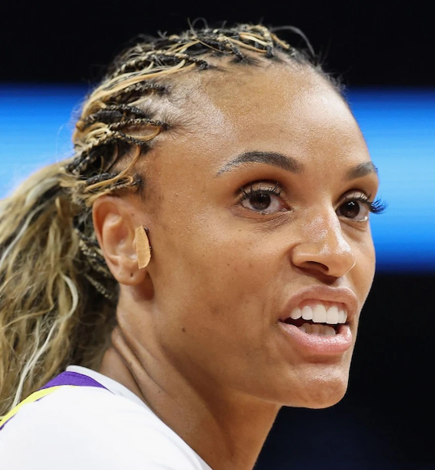 dewanna bonner teeth 2026 dewanna bonner teeth 2026