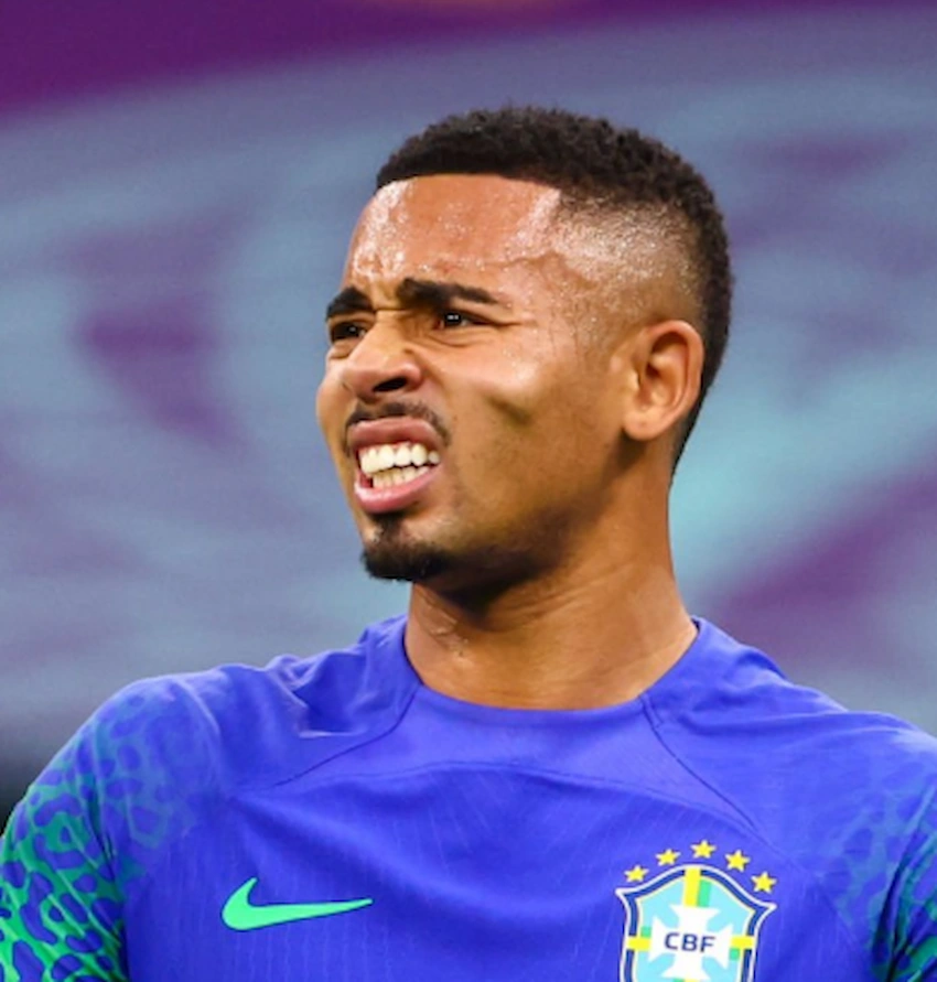 gabriel jesus teeth 2022