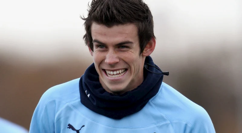 gareth bale teeth in 2010