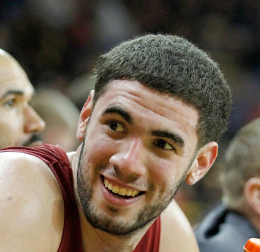 georges niang teeth 2014