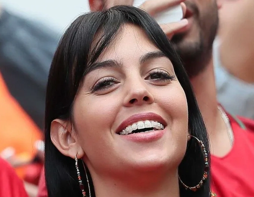 georgina rodríguez teeth before after