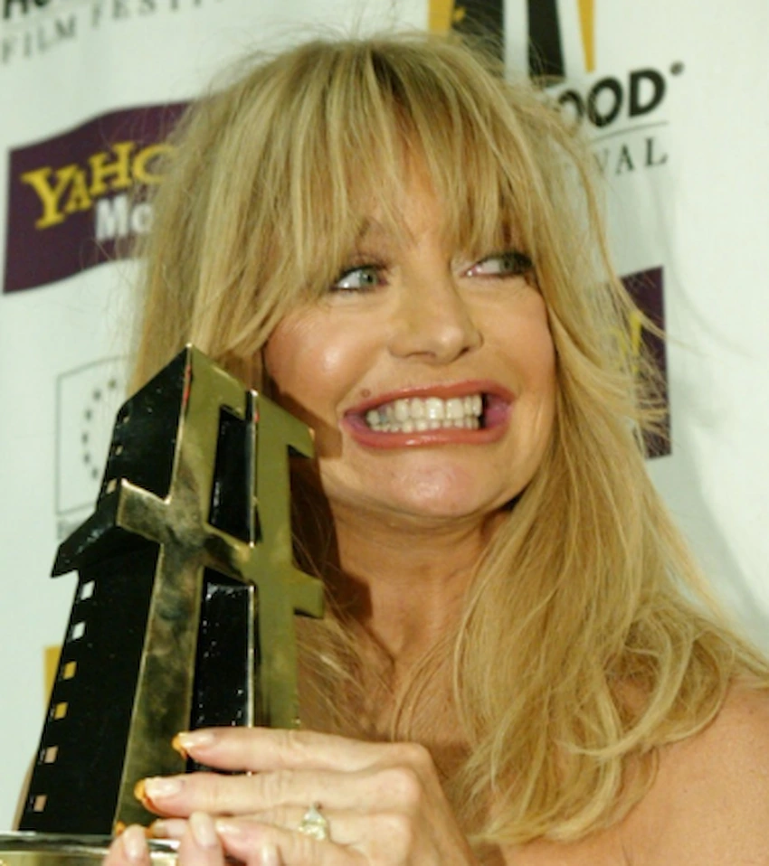 goldie hawn teeth 2003