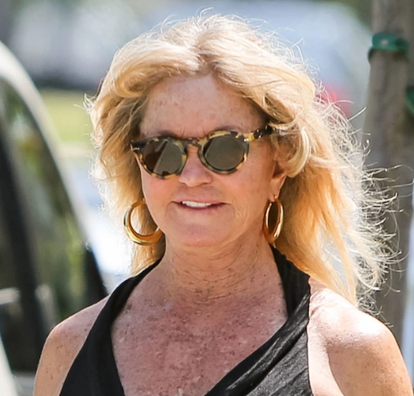 goldie hawn teeth 2020