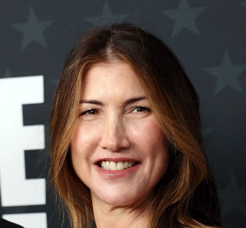 jackie sandler teeth 2026