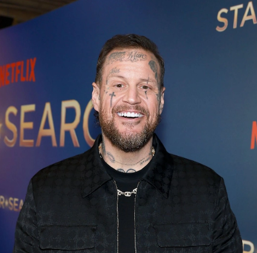 jelly roll teeth 2026 jelly roll teeth 2026