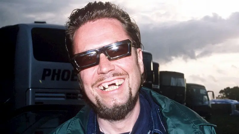 jerry dammers teeth in 2000