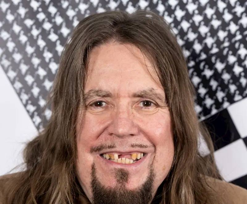 jerry dammers teeth in 2023