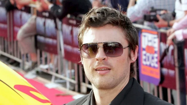 karl urban teeth in 2005