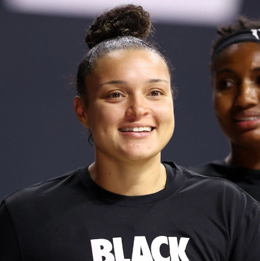 kayla mcbride teeth 2020