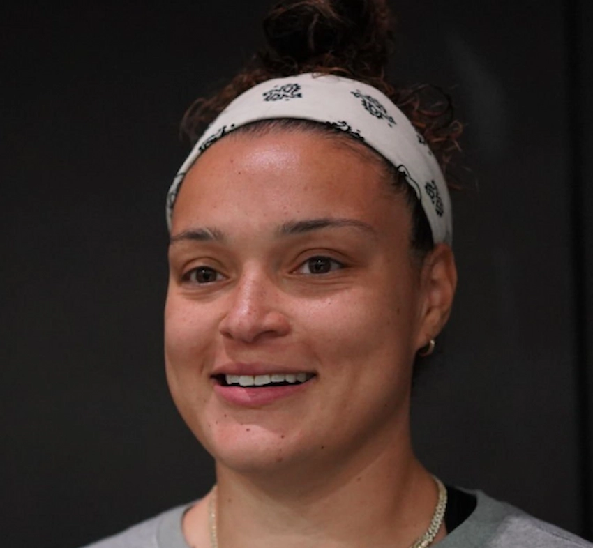kayla mcbride teeth 2023