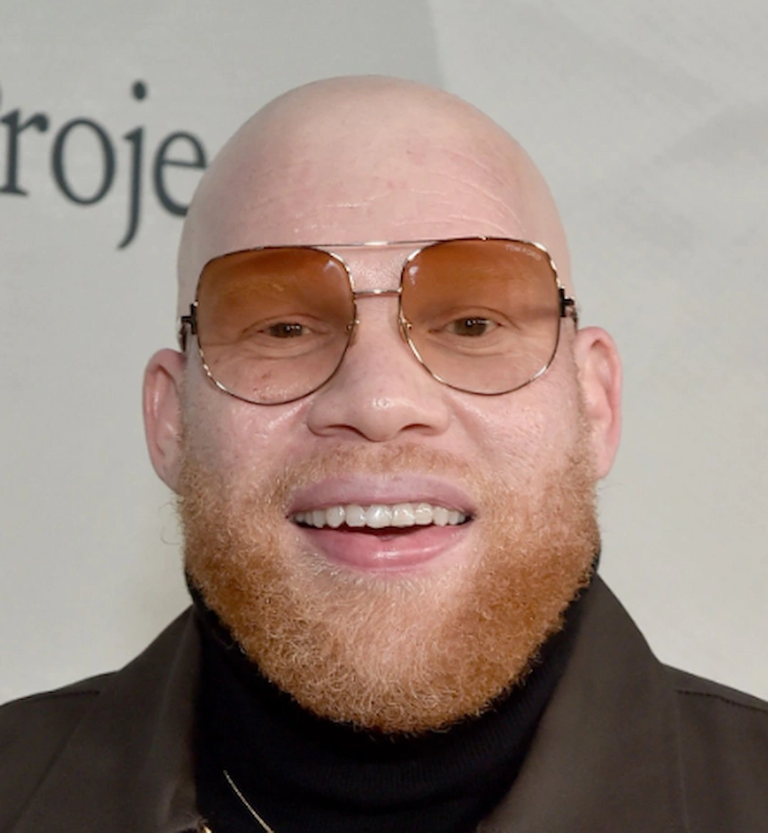 krondon teeth 2023 krondon teeth 2023