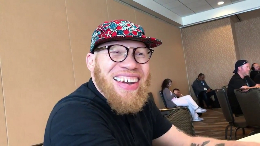 krondon teeth before after
