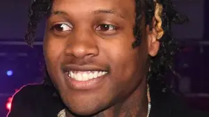 lil durk teeth before after