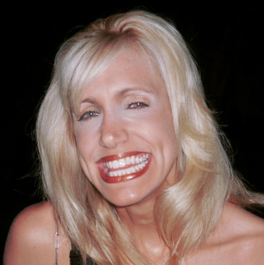 lili estefan teeth 2001