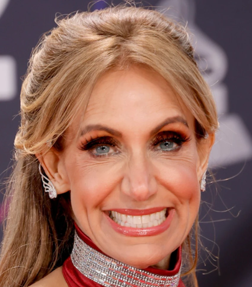 lili estefan teeth 2022