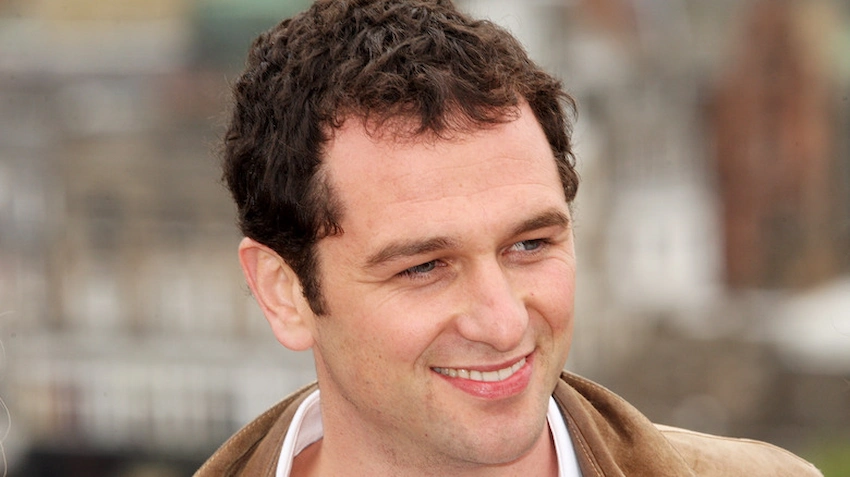 matthew rhys teeth before after