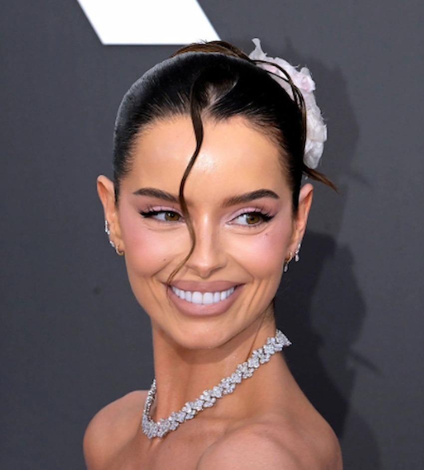 maura higgins teeth 2026 maura higgins teeth 2026