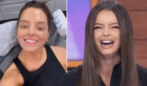 maura higgins teeth before after