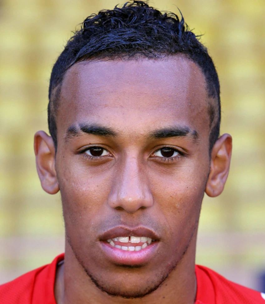 pierre emerick aubameyang teeth 2010 pierre emerick aubameyang teeth 2010