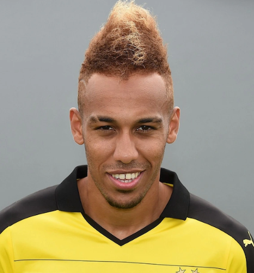 pierre emerick aubameyang teeth 2015 pierre emerick aubameyang teeth 2015
