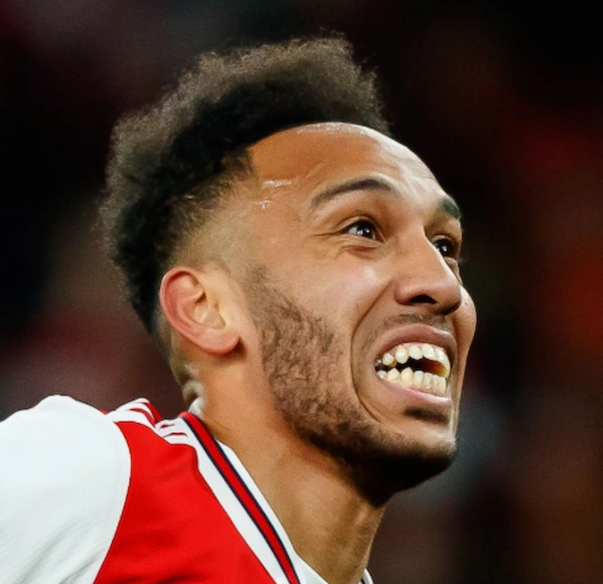 pierre emerick aubameyang teeth 2020 pierre emerick aubameyang teeth 2020