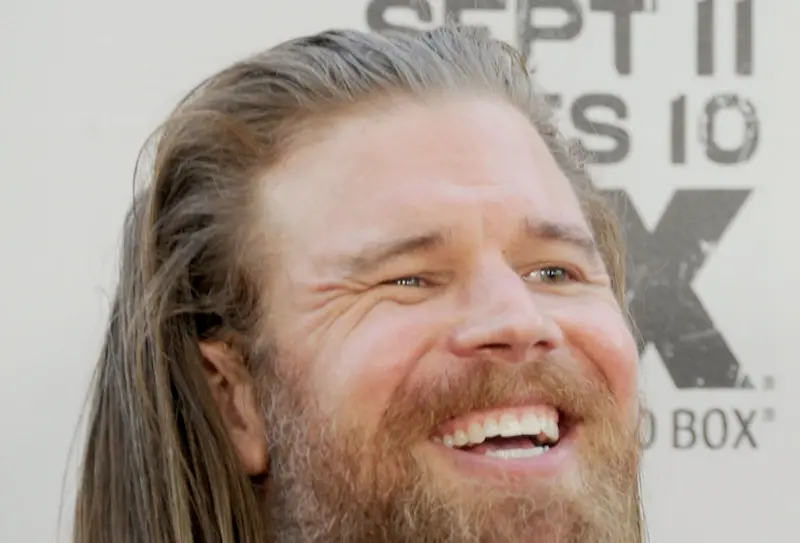 ryan hurst teeth in 2010