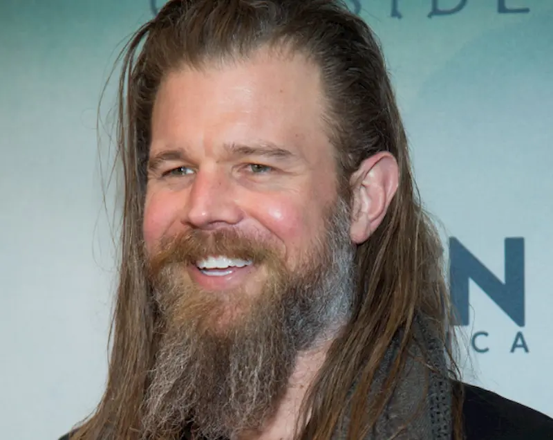 ryan hurst teeth in 2015