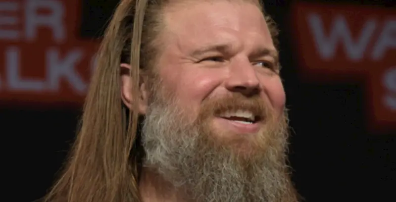 ryan hurst teeth in 2026