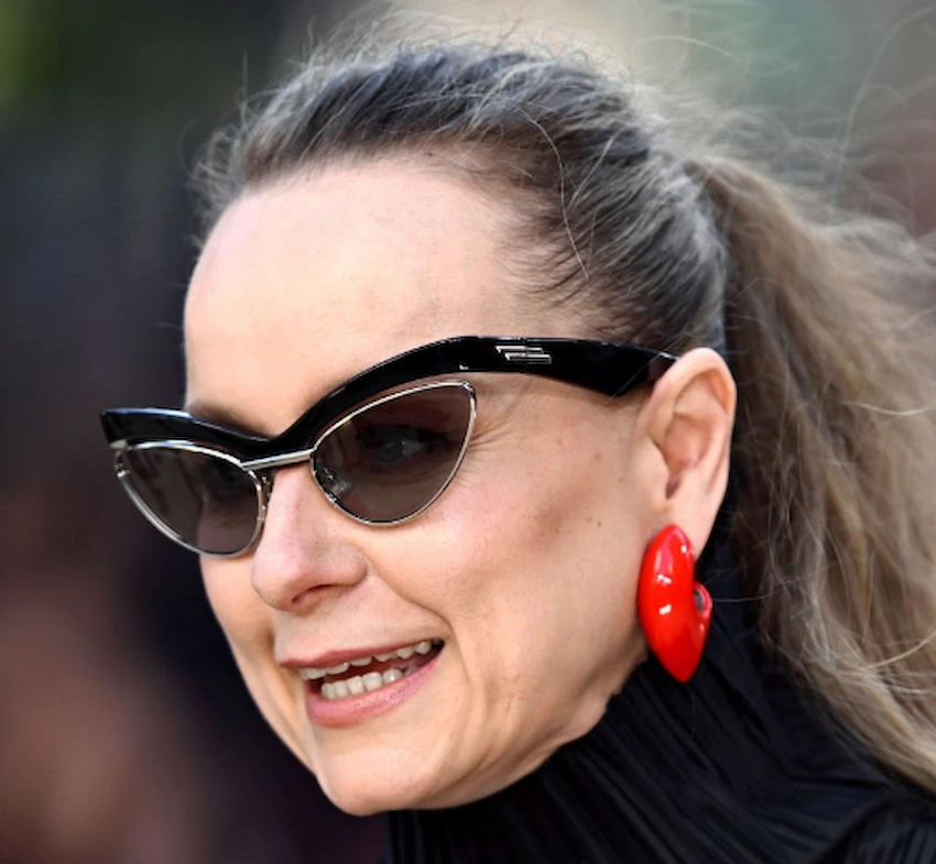 samantha morton teeth 2026
