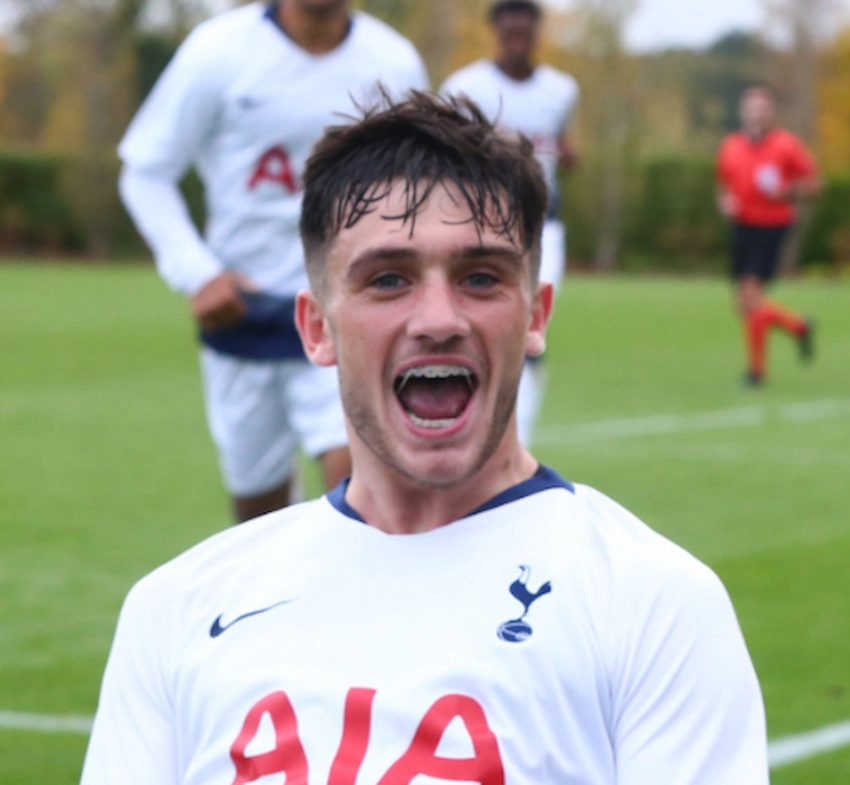 troy parrott teeth 2018 troy parrott teeth 2018