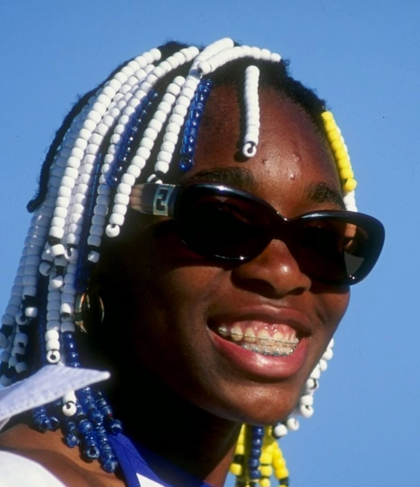 venus williams teeth 1998