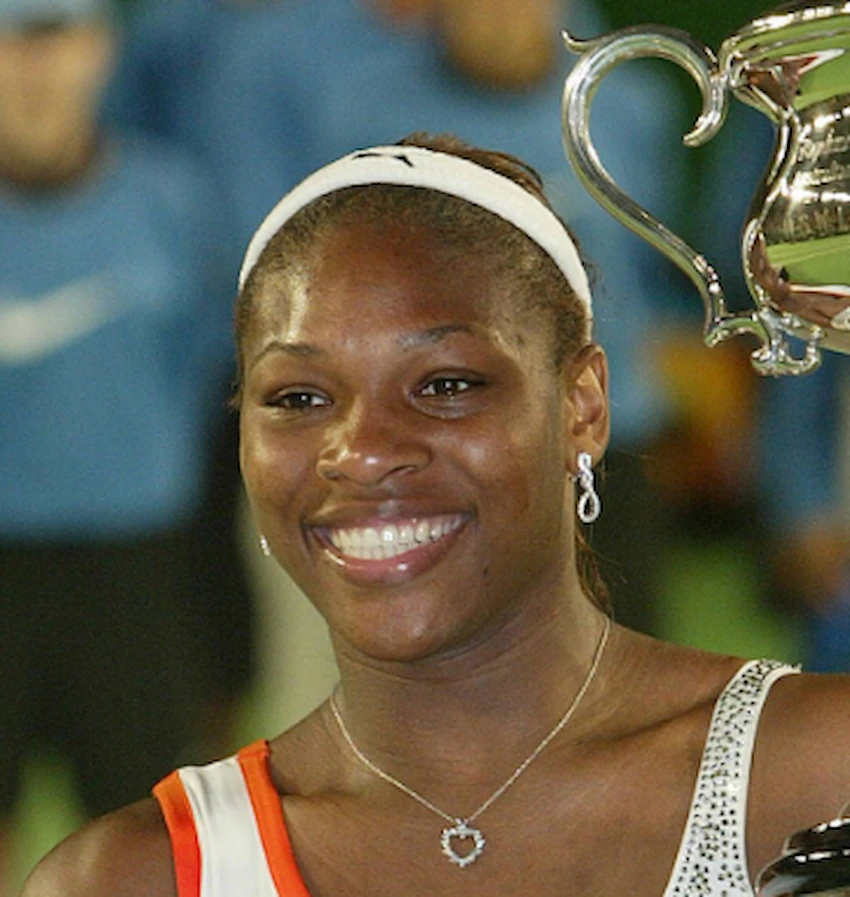 venus williams teeth 2003