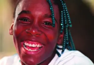 venus williams teeth before after