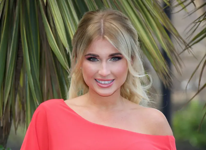 billie faiers teeth in 2015