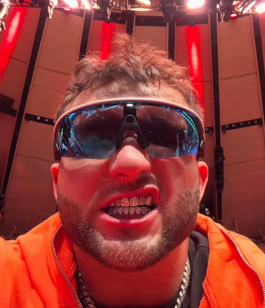 cam skattebo teeth 2025 cam skattebo teeth 2025