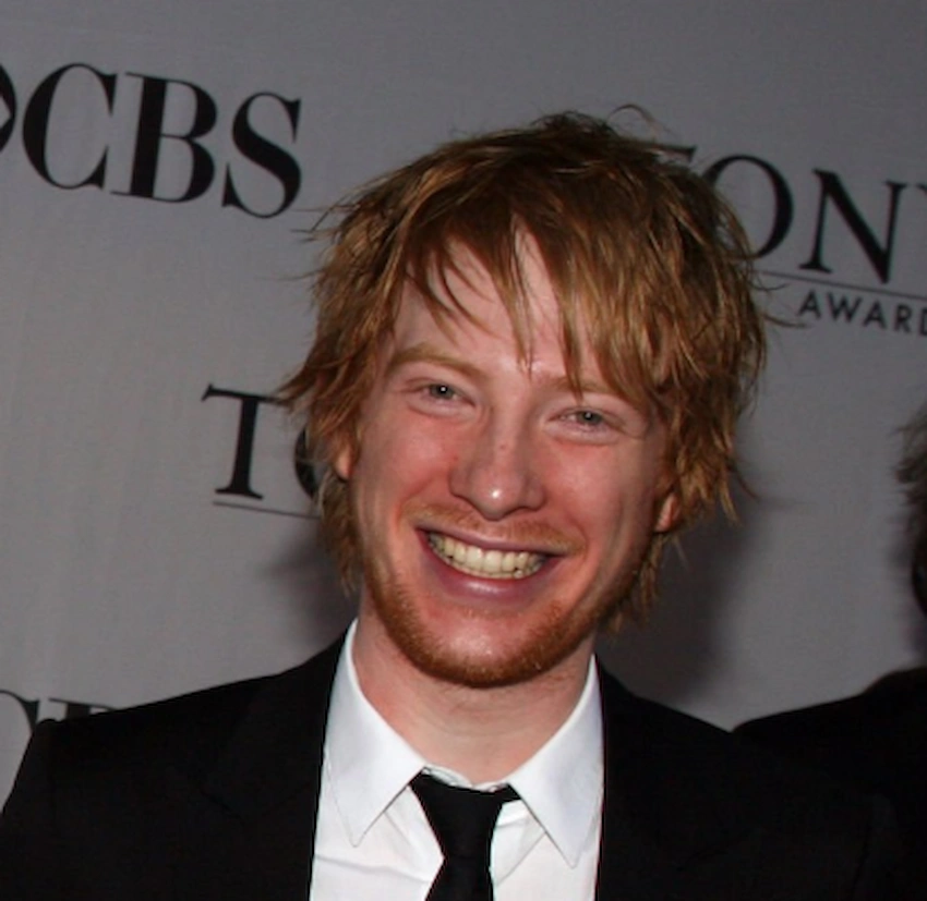 domhnall gleeson teeth 2005