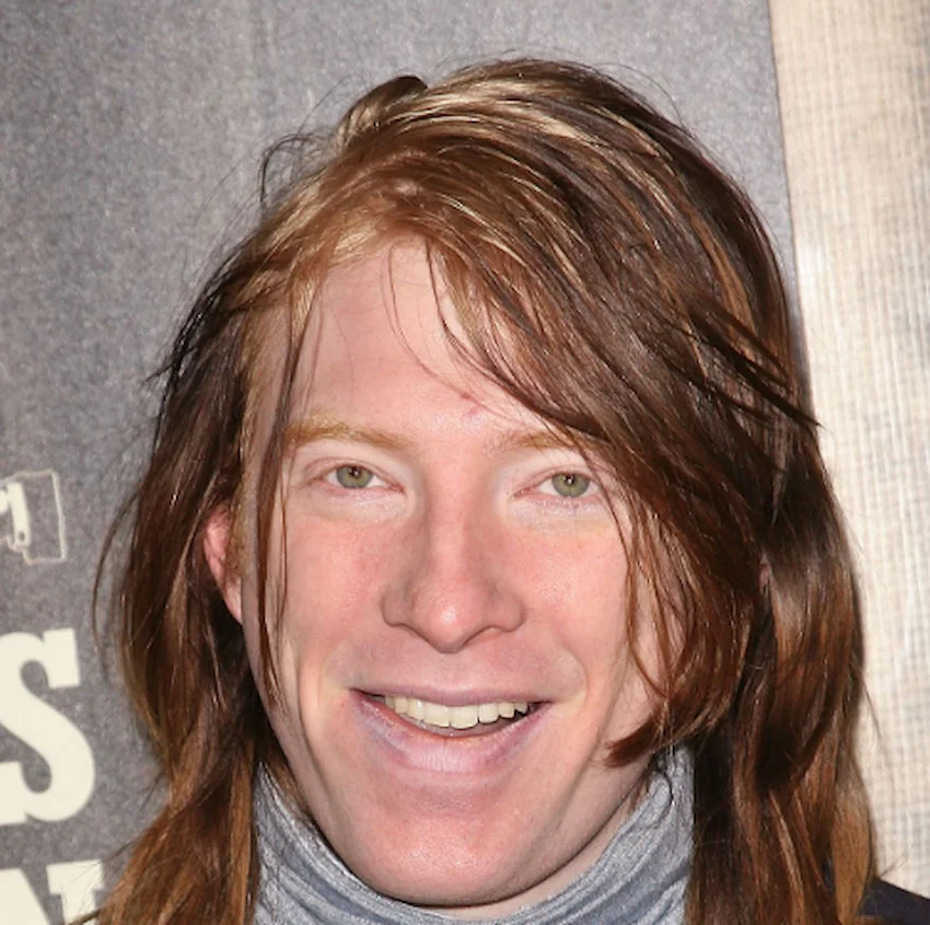 domhnall gleeson teeth 2010