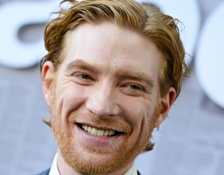 domhnall gleeson teeth before after