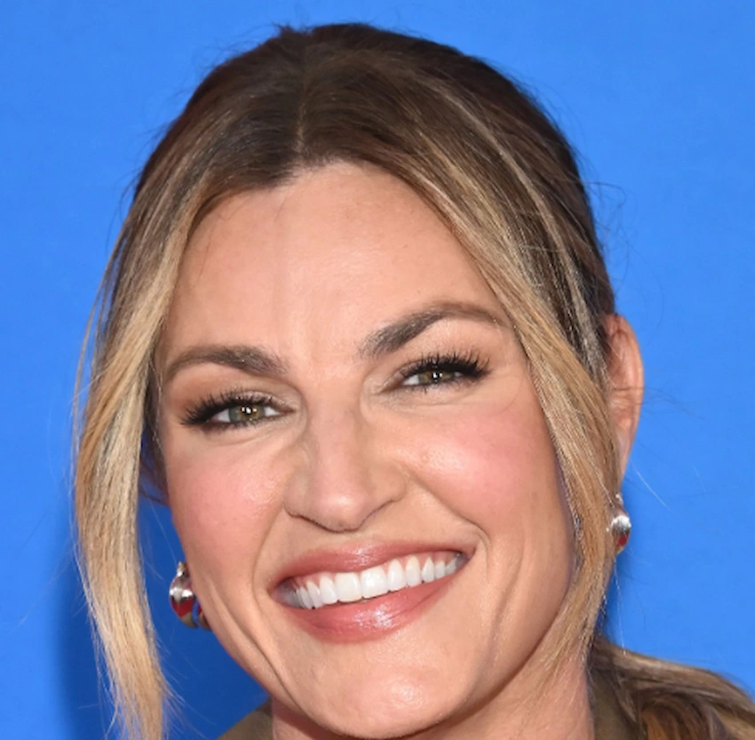 erin andrews teeth 2026 erin andrews teeth 2026