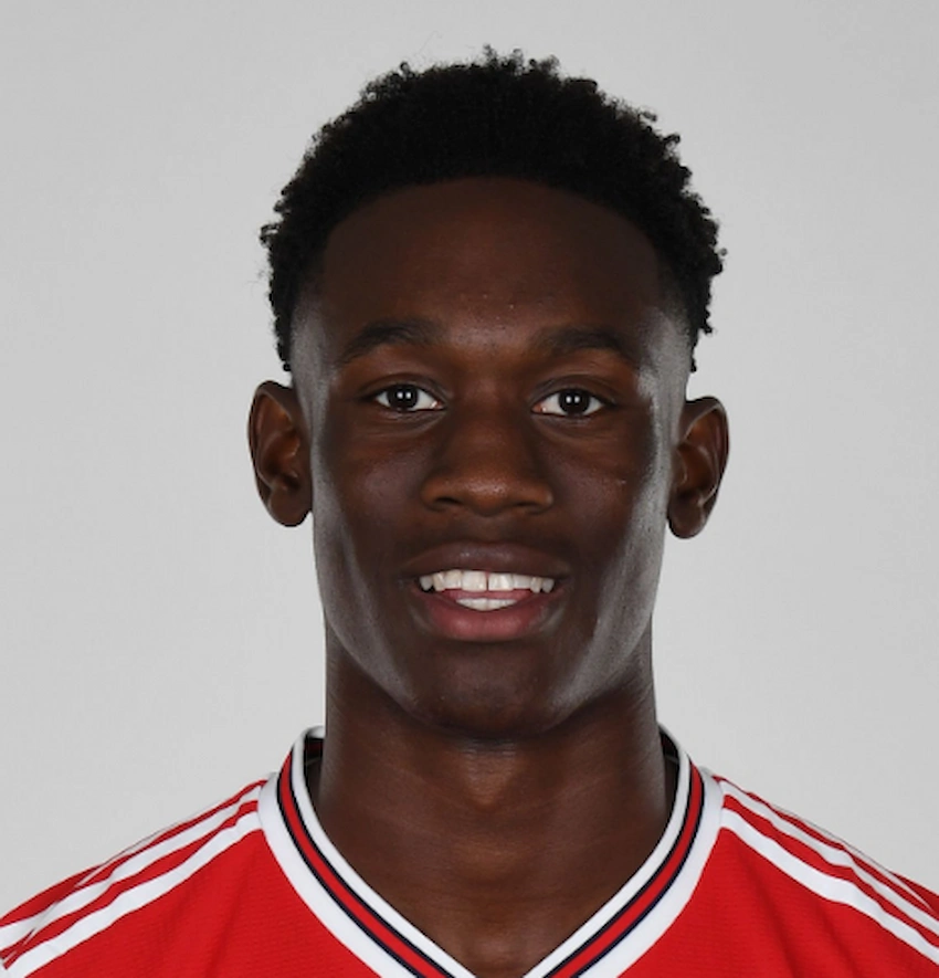 folarin balogun teeth 2019