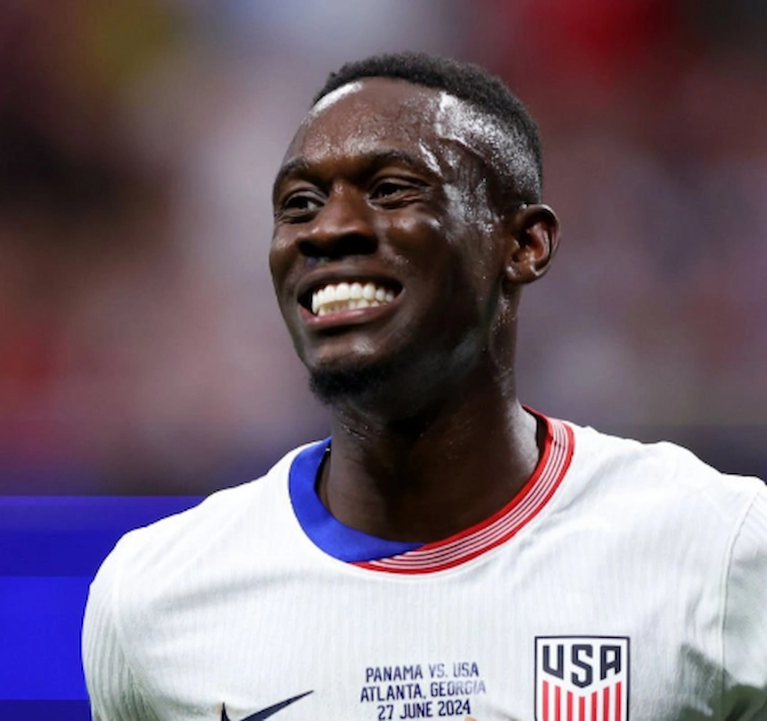 folarin balogun teeth 2024