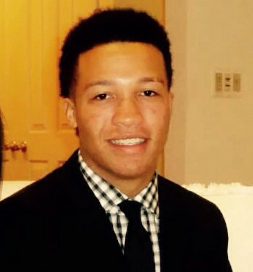 jalen brunson teeth 2014 jalen brunson teeth 2014