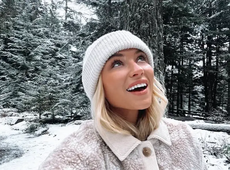 lucie donlan teeth in 2024